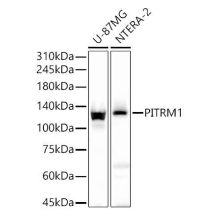 Western Blot - Anti-PITRM1 Antibody (A16166) - Antibodies.com