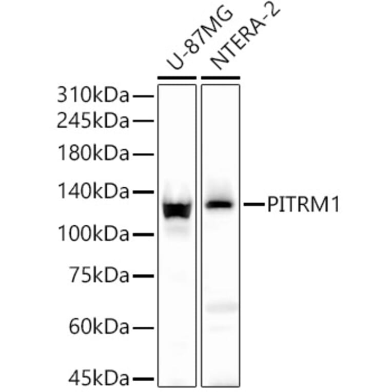 Western Blot - Anti-PITRM1 Antibody (A16166) - Antibodies.com