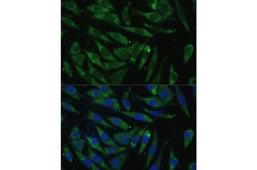 Immunofluorescence - Anti-PITRM1 Antibody (A16166) - Antibodies.com