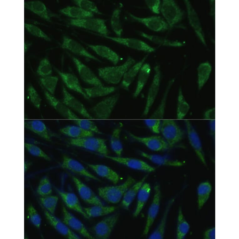 Immunofluorescence - Anti-PITRM1 Antibody (A16166) - Antibodies.com