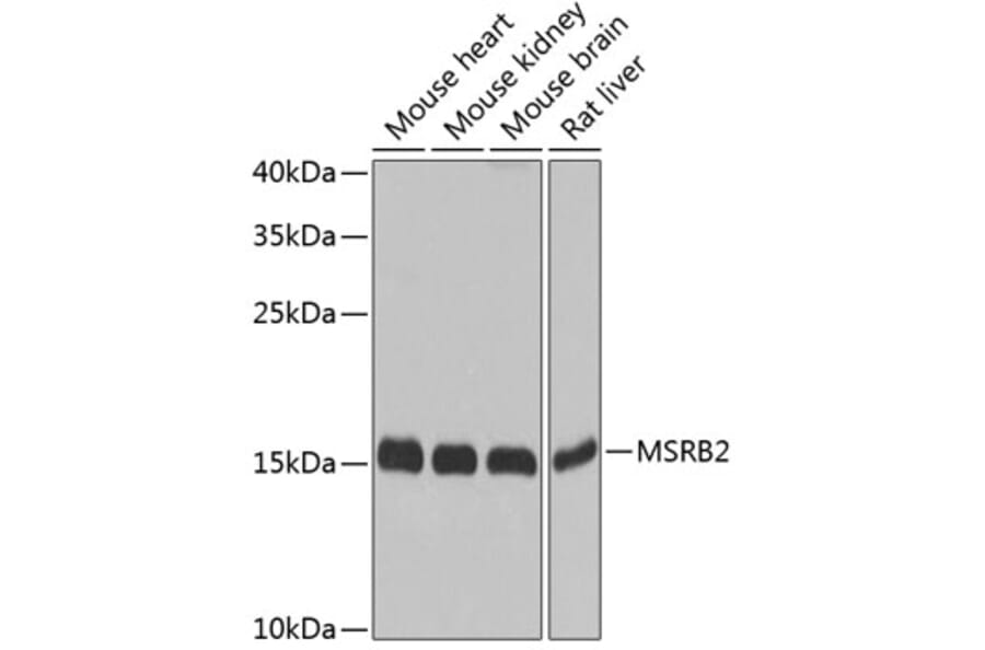 Western Blot - Anti-MSRB2 Antibody (A16167) - Antibodies.com
