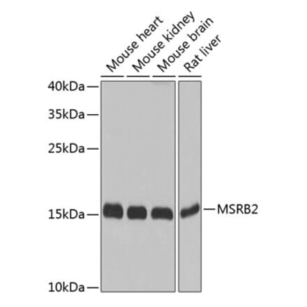 Western Blot - Anti-MSRB2 Antibody (A16167) - Antibodies.com