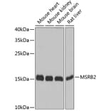 Western Blot - Anti-MSRB2 Antibody (A16167) - Antibodies.com