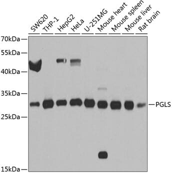 Western blot analysis of extracts of various cell lines, using Anti-PGLS Antibody (A8366) at 1:1,000 dilution.
Secondary antibody: Goat Anti-Rabbit IgG (H+L) (HRP) (AS014) at 1:10,000 dilution.
Lysates / proteins: 25µg per lane.
Blocking buffer: 3% non-fat dry milk in TBST.
Detection: ECL Basic Kit (RM00020).
Exposure time: 5s.