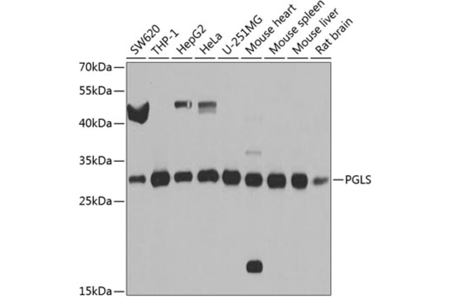 Western Blot - Anti-H6PD/GDH Antibody (A16168) - Antibodies.com