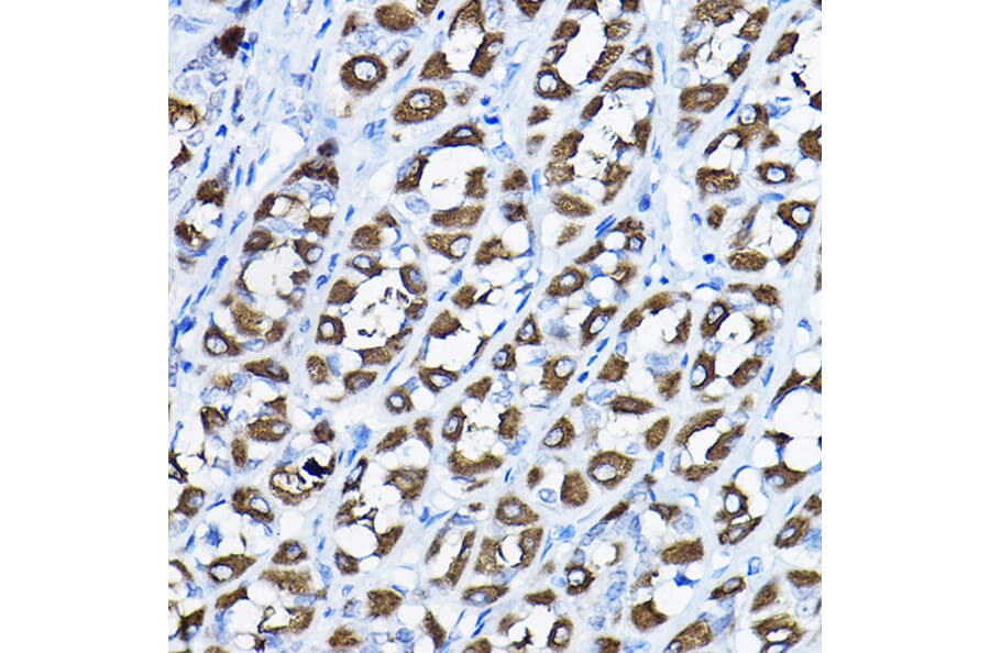 Immunohistochemistry - Anti-H6PD/GDH Antibody (A16168) - Antibodies.com