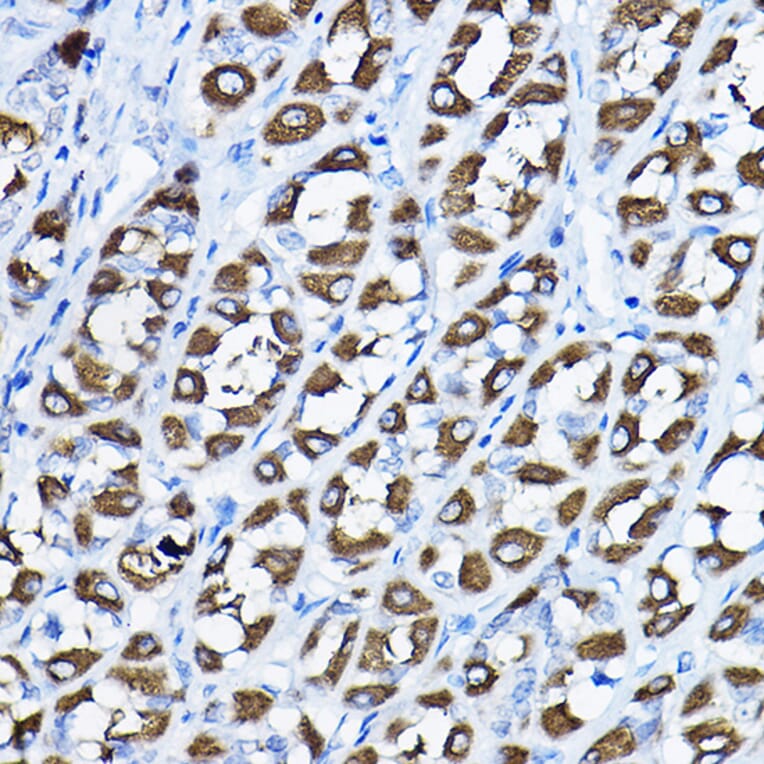 Immunohistochemistry - Anti-H6PD/GDH Antibody (A16168) - Antibodies.com