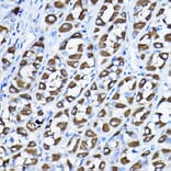 Immunohistochemistry - Anti-H6PD/GDH Antibody (A16168) - Antibodies.com
