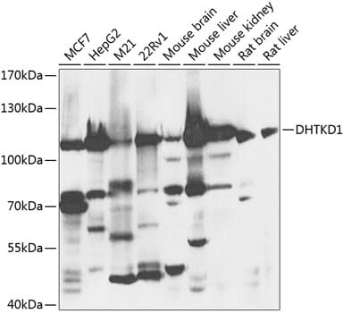 Western blot analysis of extracts of various cell lines, using Anti-DHTKD1 Antibody (A8369) at 1:1,000 dilution.
Secondary antibody: Goat Anti-Rabbit IgG (H+L) (HRP) (AS014) at 1:10,000 dilution.
Lysates / proteins: 25µg per lane.
Blocking buffer: 3% non-fat dry milk in TBST.
Detection: ECL Basic Kit (RM00020).
Exposure time: 10s.