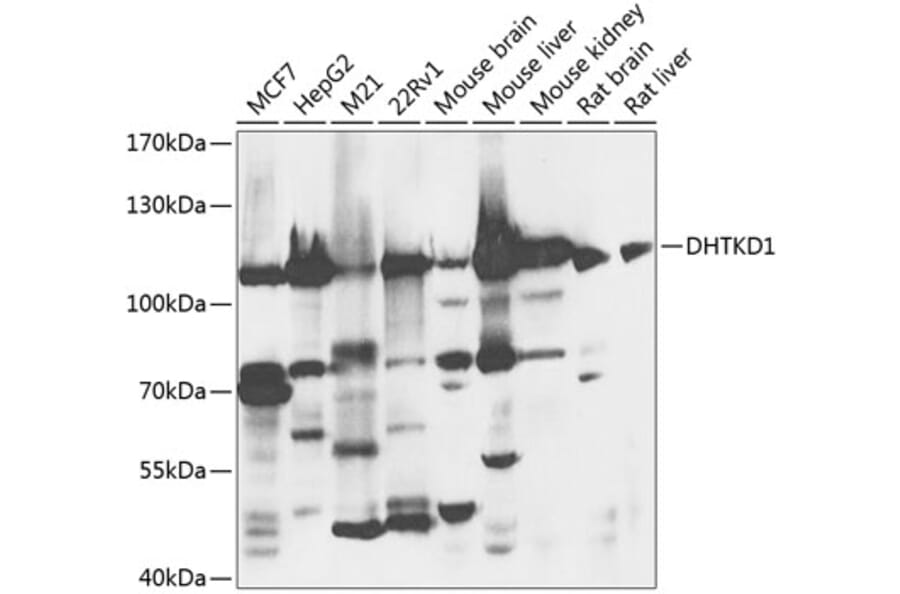 Western Blot - Anti-DHTKD1 Antibody (A16169) - Antibodies.com