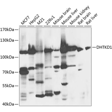 Western Blot - Anti-DHTKD1 Antibody (A16169) - Antibodies.com