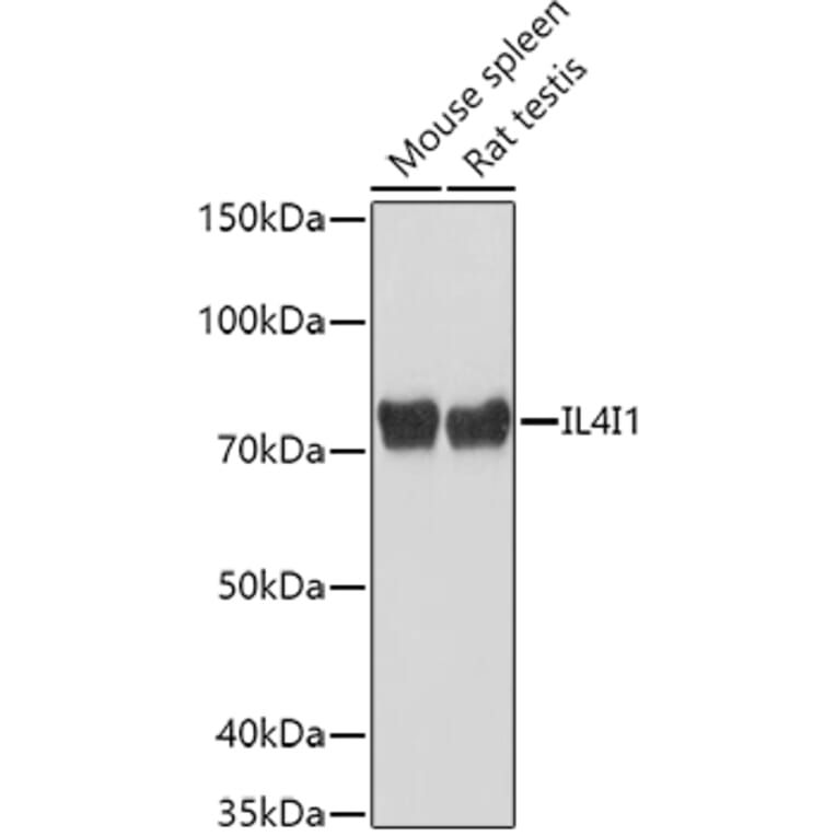 Western Blot - Anti-IL-4I1/LAO Antibody (A16170) - Antibodies.com