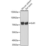 Western Blot - Anti-IL-4I1/LAO Antibody (A16170) - Antibodies.com