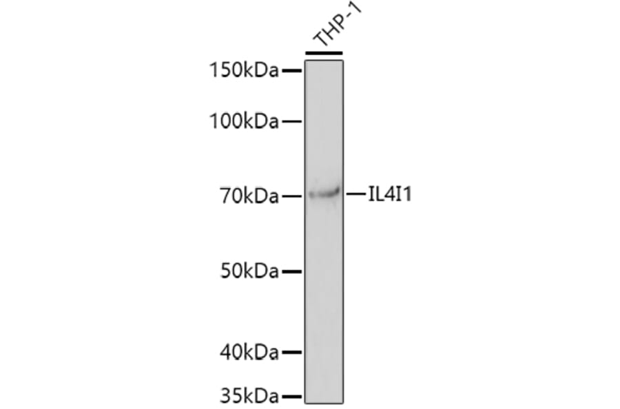 Western Blot - Anti-IL-4I1/LAO Antibody (A16170) - Antibodies.com