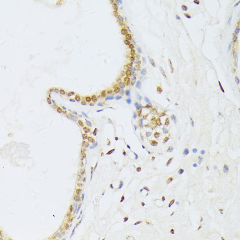 Immunohistochemistry - Anti-ANKRD52 Antibody (A16171) - Antibodies.com