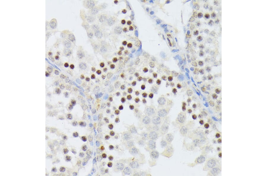 Immunohistochemistry - Anti-ANKRD52 Antibody (A16171) - Antibodies.com