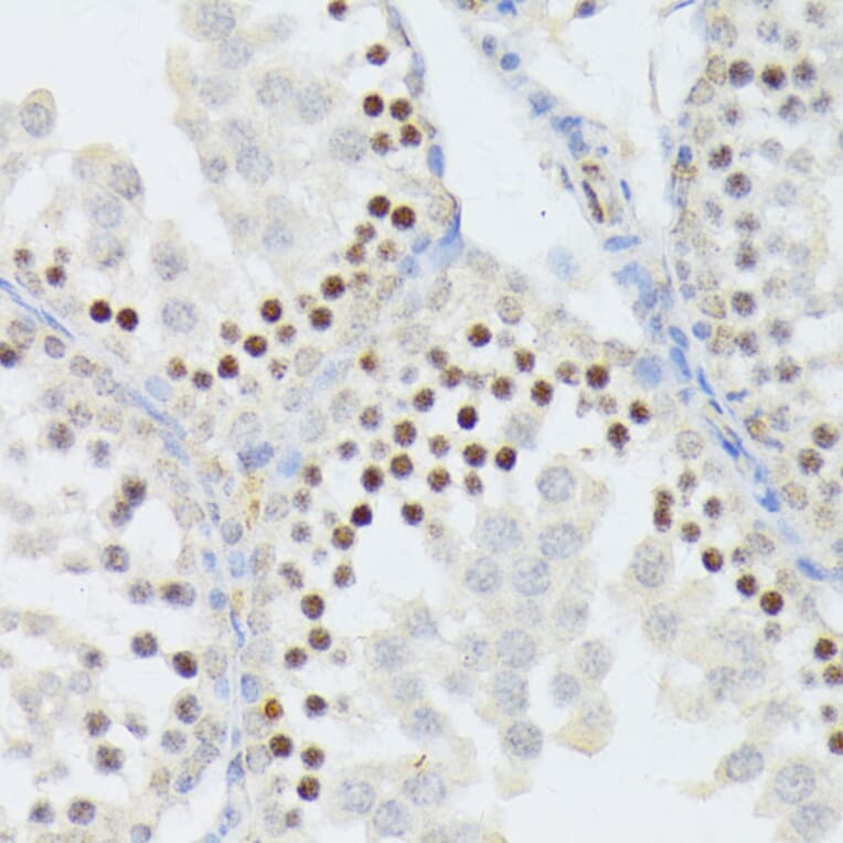 Immunohistochemistry - Anti-ANKRD52 Antibody (A16171) - Antibodies.com
