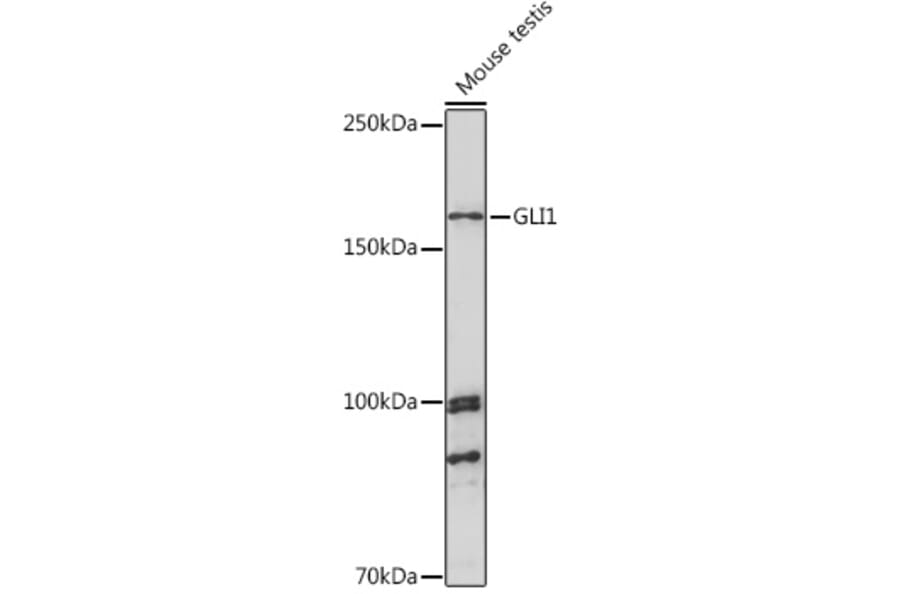 Western Blot - Anti-Gli1 Antibody (A16172) - Antibodies.com