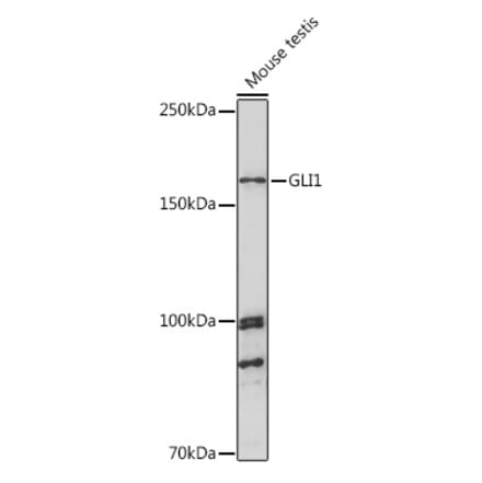 Western Blot - Anti-Gli1 Antibody (A16172) - Antibodies.com