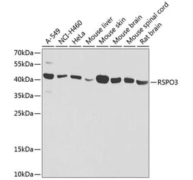 Western Blot - Anti-RSPO3 Antibody (A16173) - Antibodies.com