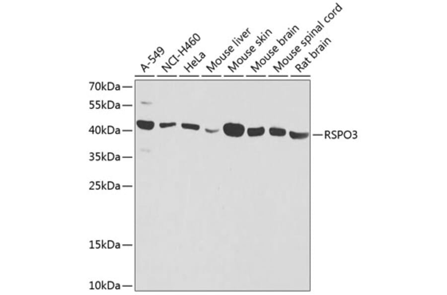 Western Blot - Anti-RSPO3 Antibody (A16173) - Antibodies.com