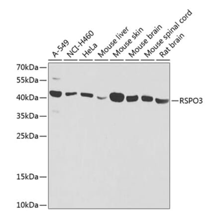 Western Blot - Anti-RSPO3 Antibody (A16173) - Antibodies.com