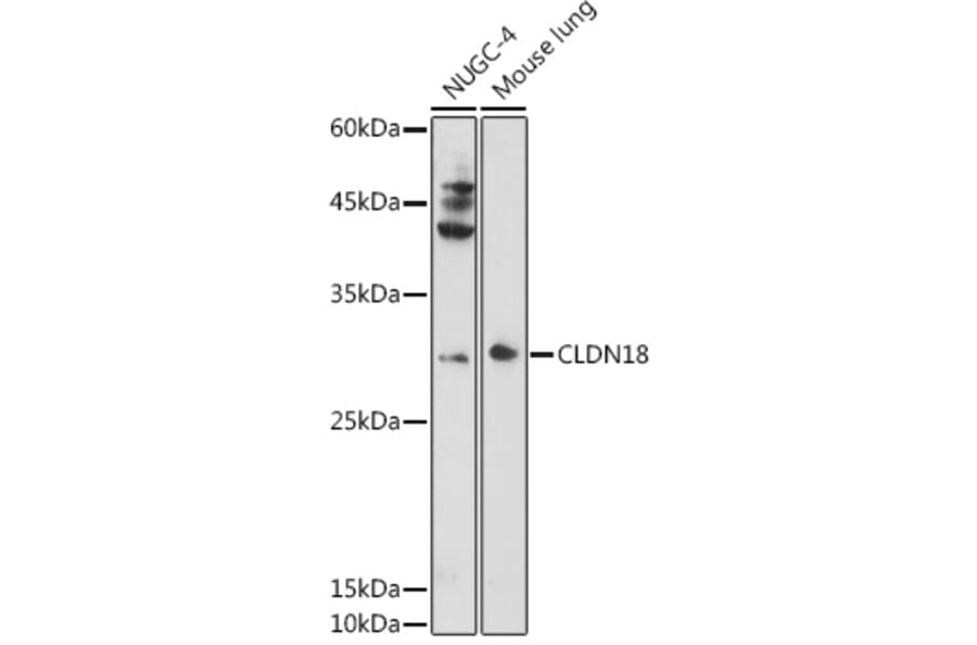 Western Blot - Anti-Claudin18 Antibody (A16174) - Antibodies.com
