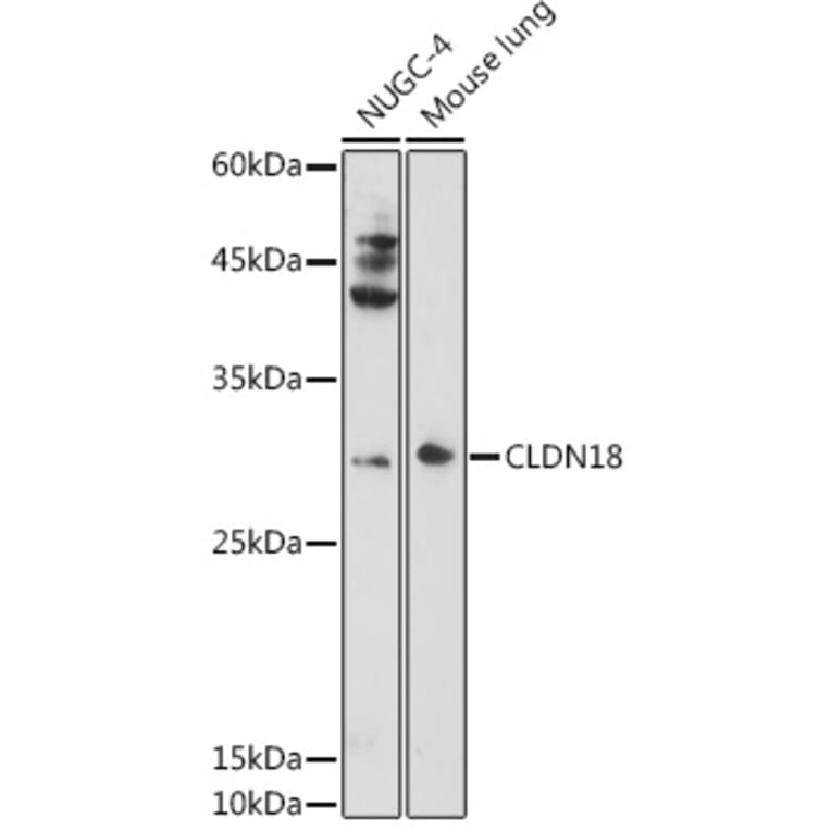Western Blot - Anti-Claudin18 Antibody (A16174) - Antibodies.com
