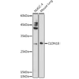 Western Blot - Anti-Claudin18 Antibody (A16174) - Antibodies.com
