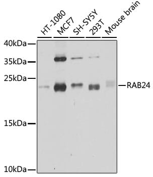 Western blot analysis of extracts of various cell lines, using Anti-RAB24 Antibody (A8394) at 1:1,000 dilution.
Secondary antibody: Goat Anti-Rabbit IgG (H+L) (HRP) (AS014) at 1:10,000 dilution.
Lysates / proteins: 25µg per lane.
Blocking buffer: 3% non-fat dry milk in TBST.
Detection: ECL Enhanced Kit (RM00021).
Exposure time: 15s.