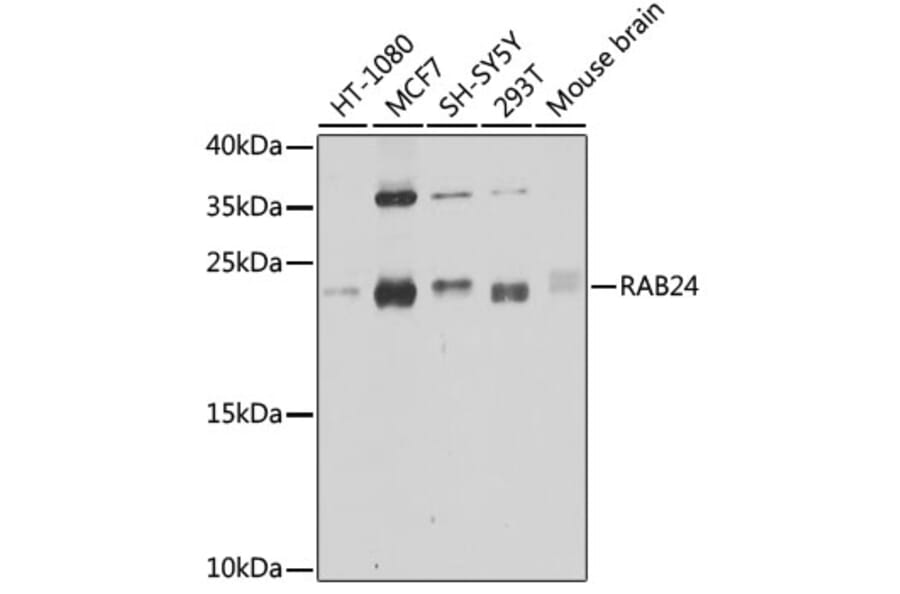 Western Blot - Anti-Rab24 Antibody (A16175) - Antibodies.com
