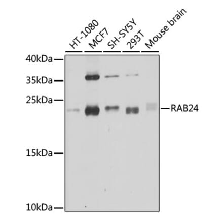 Western Blot - Anti-Rab24 Antibody (A16175) - Antibodies.com