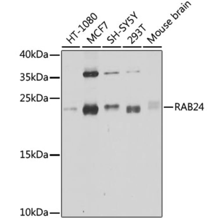 Western Blot - Anti-Rab24 Antibody (A16175) - Antibodies.com