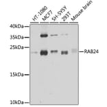 Western Blot - Anti-Rab24 Antibody (A16175) - Antibodies.com