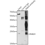 Western Blot - Anti-Rab24 Antibody (A16175) - Antibodies.com