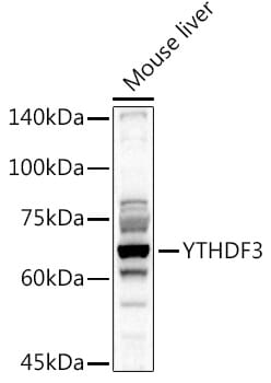 Western blot analysis of extracts of various cell lines, using Anti-YTHDF3 Antibody (A8395) at 1:1,000 dilution.
Secondary antibody: Goat Anti-Rabbit IgG (H+L) (HRP) (AS014) at 1:10,000 dilution.
Lysates / proteins: 25µg per lane.
Blocking buffer: 3% non-fat dry milk in TBST.
Detection: ECL Basic Kit (RM00020).
Exposure time: 15s.