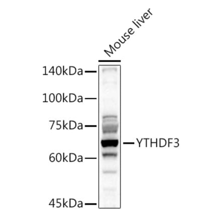 Western Blot - Anti-YTHDF3 Antibody (A16176) - Antibodies.com