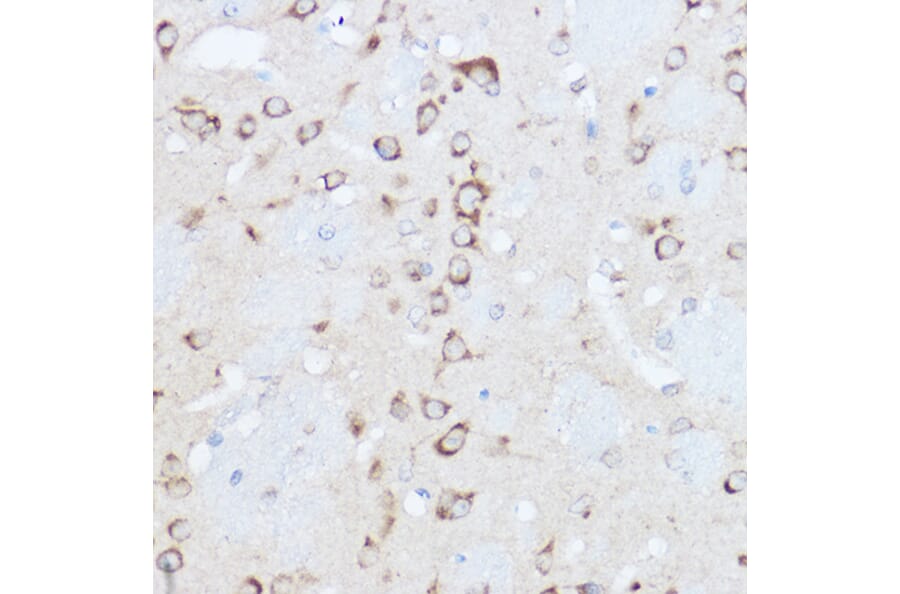 Immunohistochemistry - Anti-YTHDF3 Antibody (A16176) - Antibodies.com