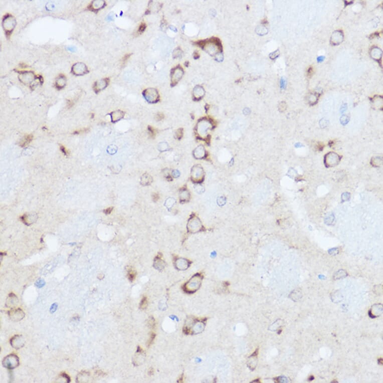 Immunohistochemistry - Anti-YTHDF3 Antibody (A16176) - Antibodies.com