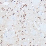 Immunohistochemistry - Anti-YTHDF3 Antibody (A16176) - Antibodies.com