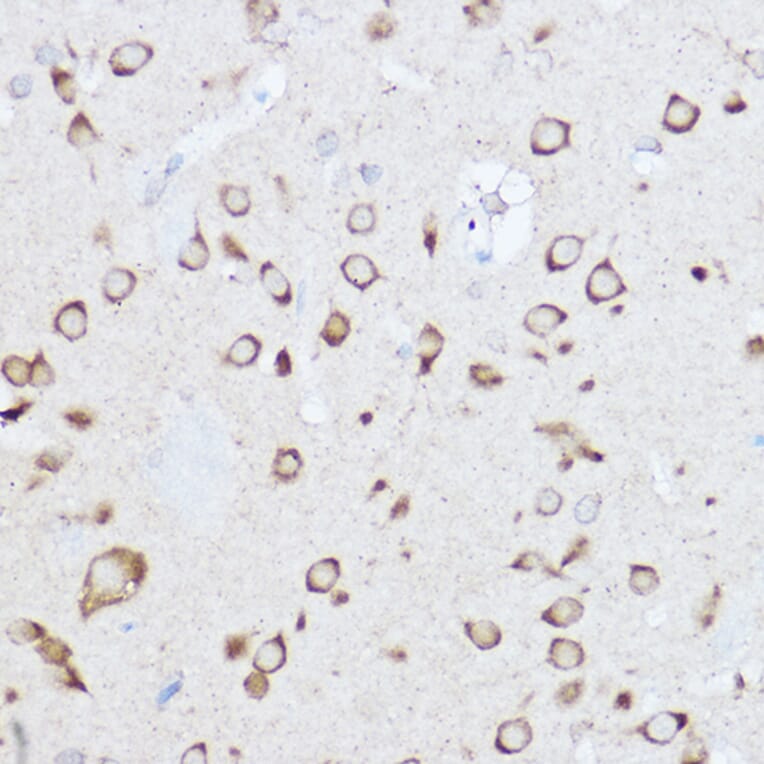 Immunohistochemistry - Anti-YTHDF3 Antibody (A16176) - Antibodies.com