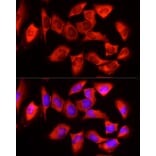 Immunofluorescence - Anti-YTHDF3 Antibody (A16176) - Antibodies.com