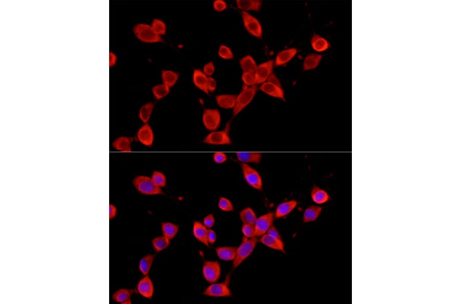 Immunofluorescence - Anti-YTHDF3 Antibody (A16176) - Antibodies.com