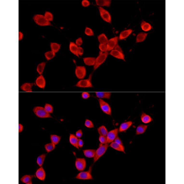 Immunofluorescence - Anti-YTHDF3 Antibody (A16176) - Antibodies.com