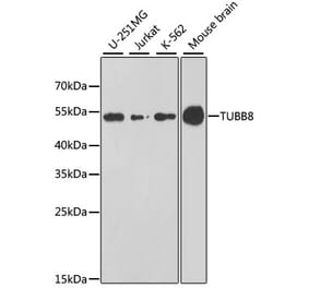 Western Blot - Anti-TUBB8 Antibody (A8396) - Antibodies.com