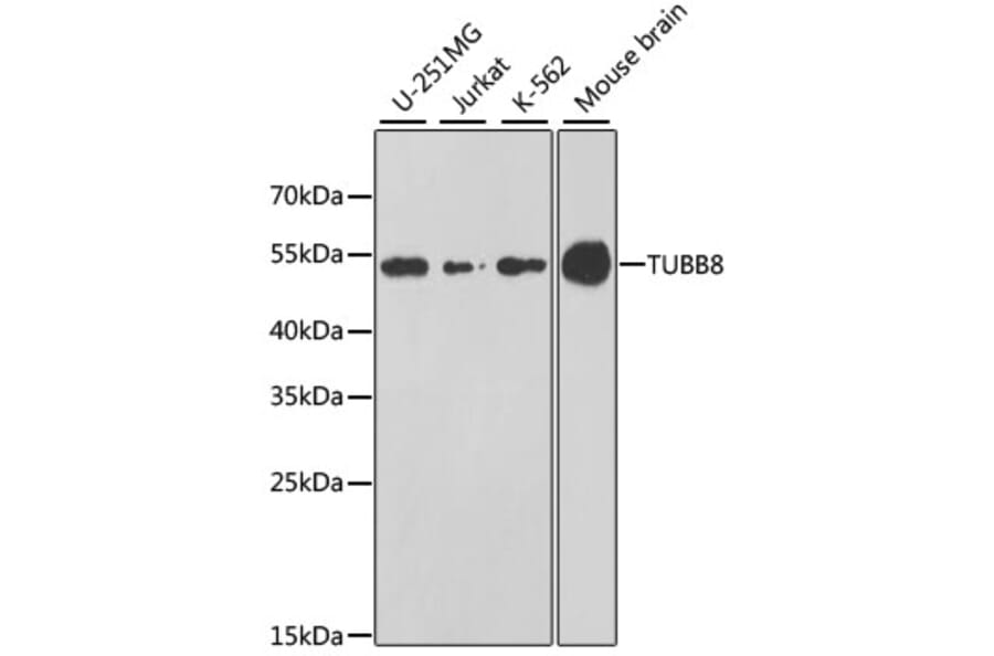 Western Blot - Anti-TUBB8 Antibody (A8396) - Antibodies.com