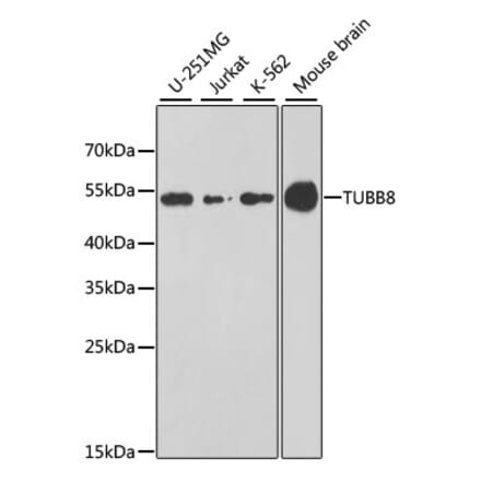 Western Blot - Anti-TUBB8 Antibody (A16177) - Antibodies.com
