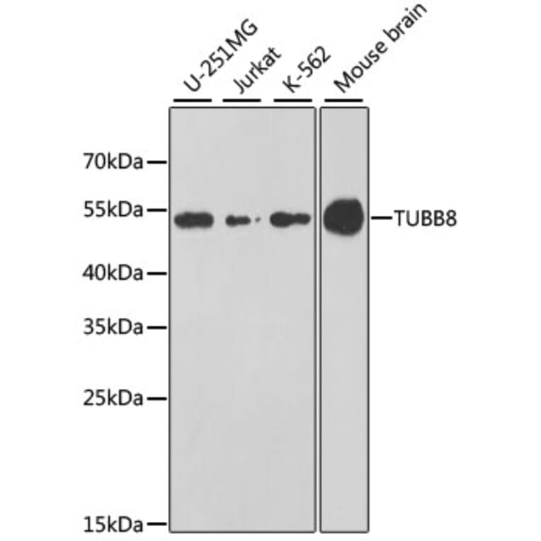 Western Blot - Anti-TUBB8 Antibody (A8396) - Antibodies.com