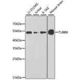 Western Blot - Anti-TUBB8 Antibody (A8396) - Antibodies.com