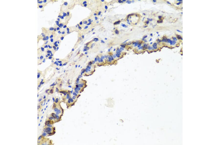 Immunohistochemistry - Anti-TUBB8 Antibody (A8396) - Antibodies.com